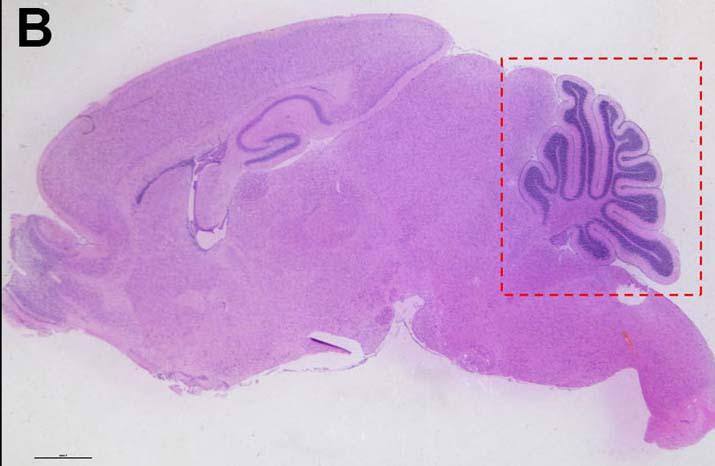 Photo of Cerebellum