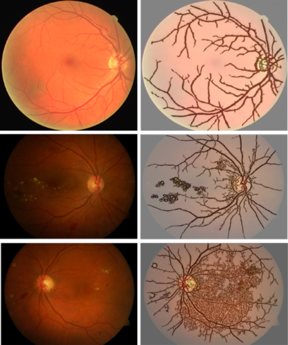 images of retina 