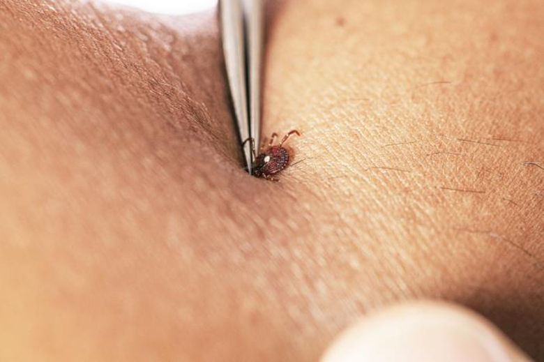 A lone star tick is removed from a person's arm with fine-tipped tweezers.